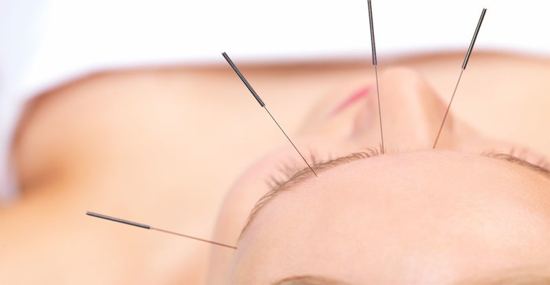 Dr. Vasile Ardeleanu - Cabinet Medical Individual Acupunctura